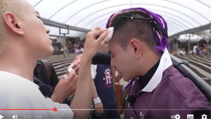Lê Dương Bảo Lâm gặp tai nạn chảy máu đầu